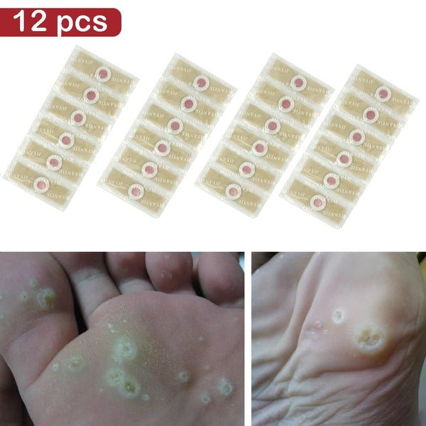 12pcs Medical Plaster Foot Corn Removal Warts Thorn patch  Corn of feet Calluses Callosity Detox clavus  Medical Patch